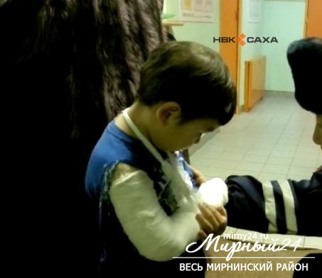 Пострадавшему в ДТП в Мирнинском районе ребенку делают операцию в Якутске фото 2